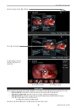 Preview for 20 page of MediCapture MVR User Manual