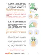 Предварительный просмотр 21 страницы Medin Miniflow REF 4000 Instructions For Use Manual