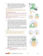 Предварительный просмотр 31 страницы Medin Miniflow REF 4000 Instructions For Use Manual