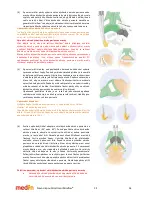 Предварительный просмотр 36 страницы Medin Miniflow REF 4000 Instructions For Use Manual