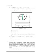 Предварительный просмотр 106 страницы MediSono P25 EXP User Manual