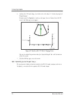 Предварительный просмотр 114 страницы MediSono P25 EXP User Manual