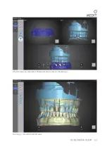 Предварительный просмотр 58 страницы Medit Identica hybrid User Manual