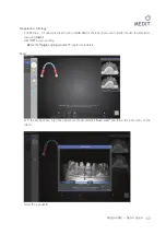 Предварительный просмотр 64 страницы Medit Identica hybrid User Manual