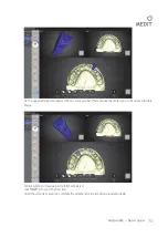 Предварительный просмотр 74 страницы Medit Identica hybrid User Manual