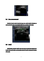 Preview for 56 page of Meditech C-Scan User Manual