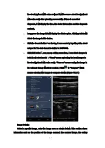 Preview for 68 page of Meditech C-Scan User Manual