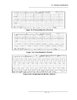 Preview for 175 page of Medrad Veris 8600 Operation Manual