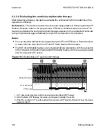 Предварительный просмотр 312 страницы Medtronic PROTECTA XT DR D314DRG Clinician Manual