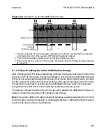 Preview for 361 page of Medtronic PROTECTA XT DR D314DRG Clinician Manual