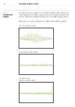 Preview for 36 page of MESI mTABLET ABI Instructions For Use Manual