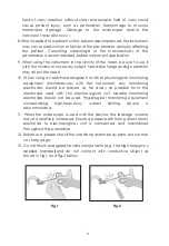 Preview for 4 page of Micro-Tech Polypectomy Snare Instructions For Use Manual