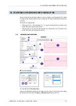 Preview for 35 page of MicroPort CRM SORIN SPIDER SAS User Manual