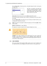 Preview for 38 page of MicroPort CRM SORIN SPIDER SAS User Manual