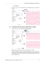 Preview for 41 page of MicroPort CRM SORIN SPIDER SAS User Manual