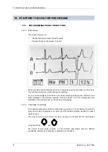 Preview for 22 page of MicroPort SpiderView User Manual