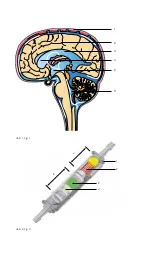 Preview for 3 page of MIETHKE GAV Patient Handbook