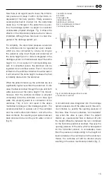 Preview for 15 page of MIETHKE GAV Patient Handbook