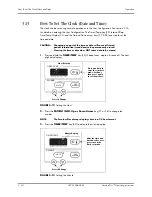 Preview for 63 page of Mindray accutorr plus Operating Instructions Manual