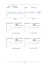 Preview for 83 page of Mindray BeneFusion VP5 Operator'S Manual