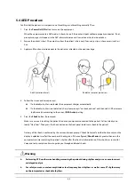 Preview for 33 page of Mindray BeneHeart D1 Operator'S Manual