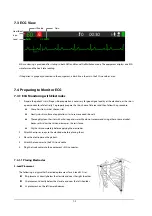 Preview for 44 page of Mindray BeneHeart D1 Operator'S Manual