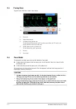 Preview for 80 page of Mindray BeneHeart D2 Operator'S Manual