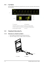 Preview for 102 page of Mindray BeneHeart D2 Operator'S Manual