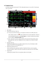 Preview for 36 page of Mindray BeneView T1 Operator'S Manual