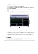 Preview for 51 page of Mindray BeneView T1 Operator'S Manual