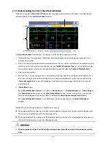 Preview for 55 page of Mindray BeneView T1 Operator'S Manual