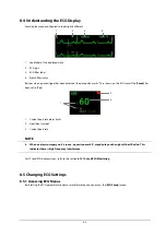 Preview for 91 page of Mindray BeneView T1 Operator'S Manual