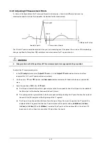 Preview for 98 page of Mindray BeneView T1 Operator'S Manual