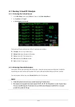 Preview for 109 page of Mindray BeneView T1 Operator'S Manual