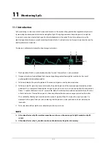 Preview for 123 page of Mindray BeneView T1 Operator'S Manual