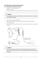 Preview for 142 page of Mindray BeneView T1 Operator'S Manual