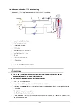 Preview for 165 page of Mindray BeneView T1 Operator'S Manual