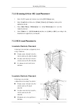 Preview for 78 page of Mindray BeneView T8 Operation Manual