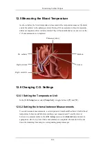 Preview for 130 page of Mindray BeneView T8 Operation Manual