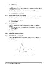 Preview for 107 page of Mindray BeneVision N1 Operator'S Manual