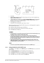 Preview for 147 page of Mindray BeneVision N1 Operator'S Manual