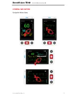 Preview for 7 page of Mindray BeneVision TD60 Quick Reference Manual