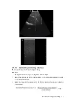 Предварительный просмотр 85 страницы Mindray DC-25 Service Manual