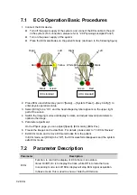 Preview for 152 page of Mindray DC-35 Operator'S Manual