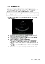 Preview for 245 page of Mindray DC-35 Operator'S Manual