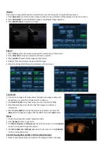 Preview for 3 page of Mindray DC-8 EXP Quick Manual