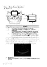 Предварительный просмотр 64 страницы Mindray DC-80A Operator'S Manual