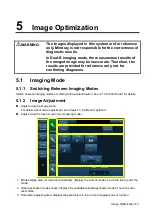 Предварительный просмотр 81 страницы Mindray DC-80A Operator'S Manual