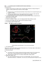 Предварительный просмотр 111 страницы Mindray DC-80A Operator'S Manual