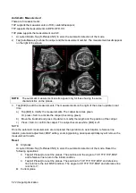 Предварительный просмотр 152 страницы Mindray DC-80A Operator'S Manual